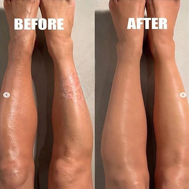 Body whitening lotion