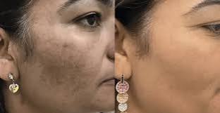 beatking face whitening cream with facewash , reduce dark spot and brightens skin tone 50g
