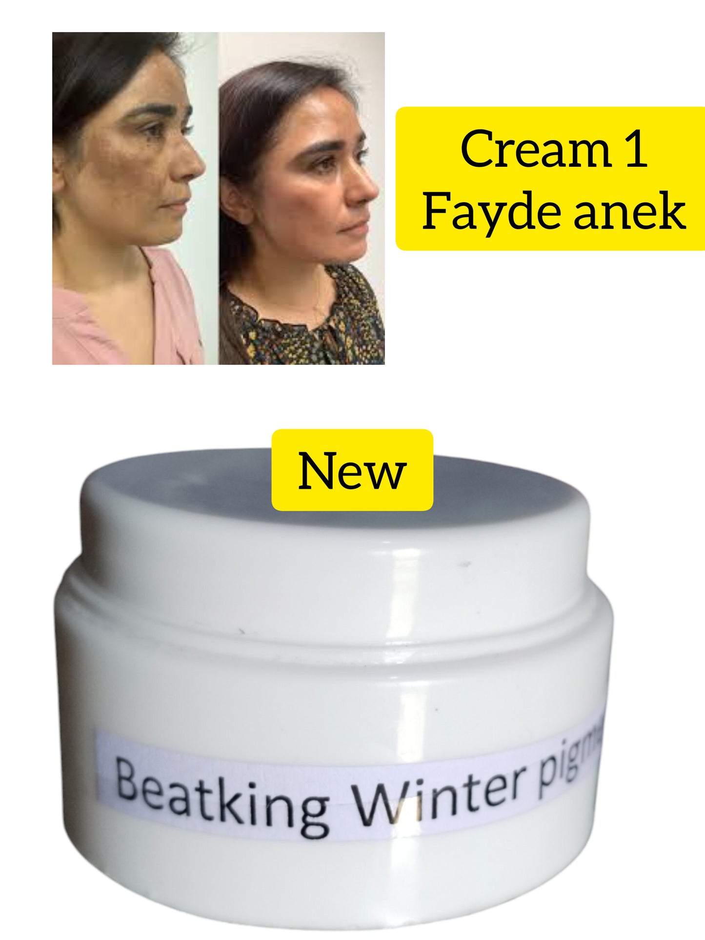 Beatking winter pigmentation cream 50g| man and woman| pure herbal no side effects