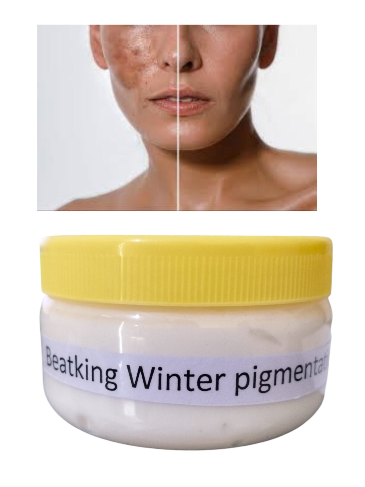 Beatking winter pigmentation cream 150gfor man and women