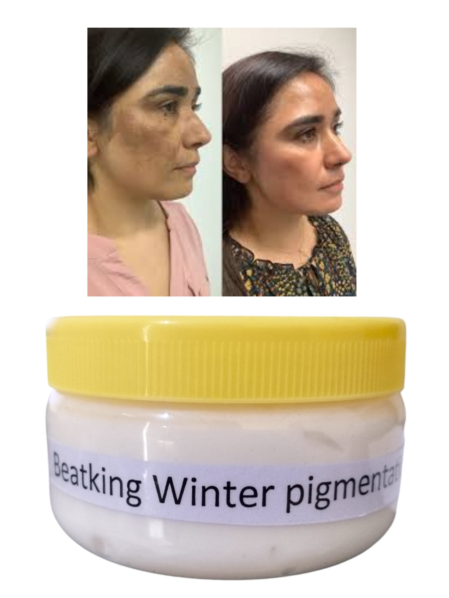 Beatking winter pigmentation cream 150gfor man and women