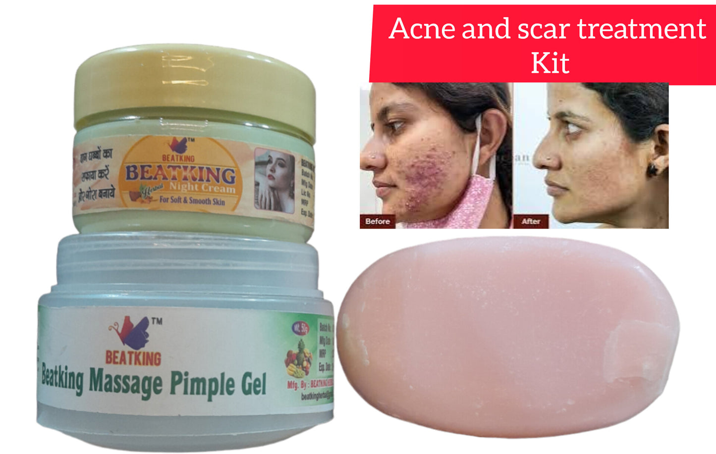 Beatking Acne And Scar Treatment Kit