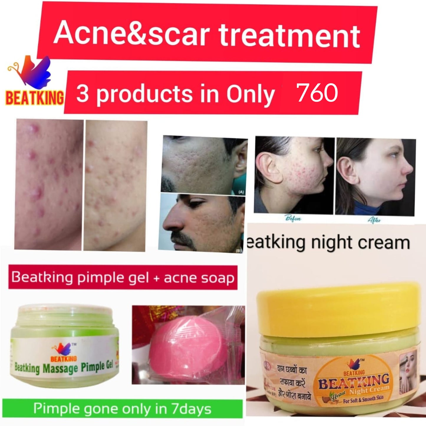 Beatking Acne And Scar Treatment Kit