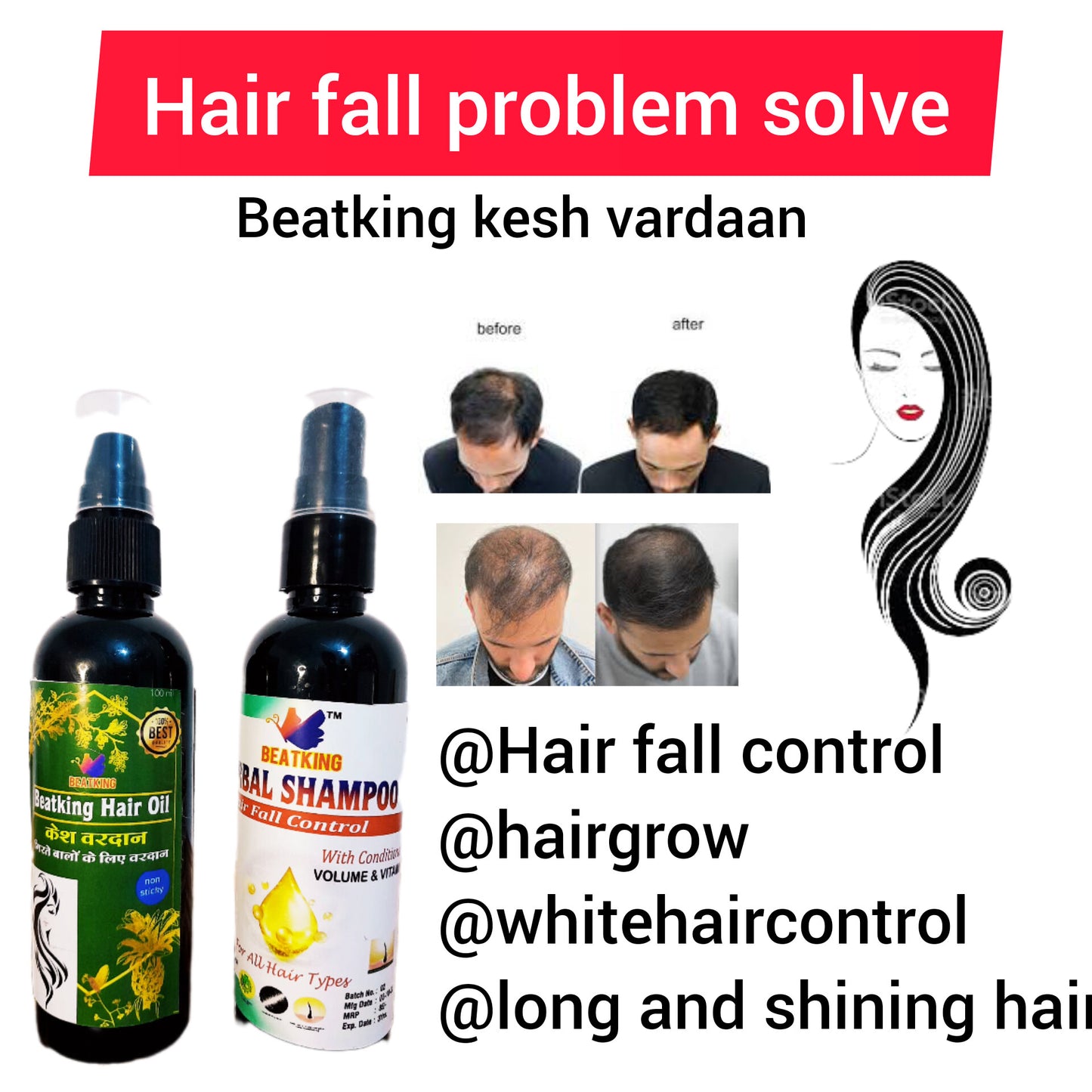 Beatking kesh vardaan hair oil and shampoo combo pack Reduces Hair Fall And Grows New Hair, 100% Ayurvedic Oil, 100 ml