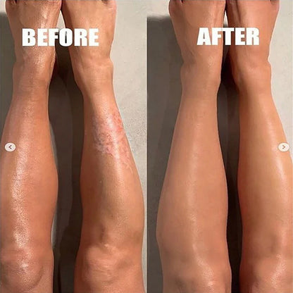 Body whitening lotion