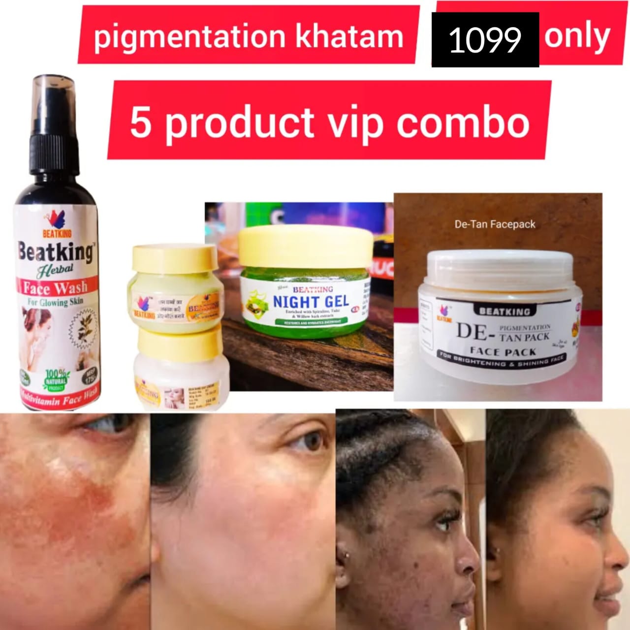9 type skin problem solution kit for pigmentation,darkspot ,melasma, openpores