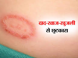 Beatking antifungal Ayurvedic Kit| Beatking Super Balm and anti fungal soap