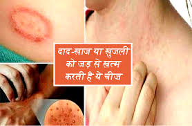 Beatking antifungal Ayurvedic Kit| Beatking Super Balm and anti fungal soap