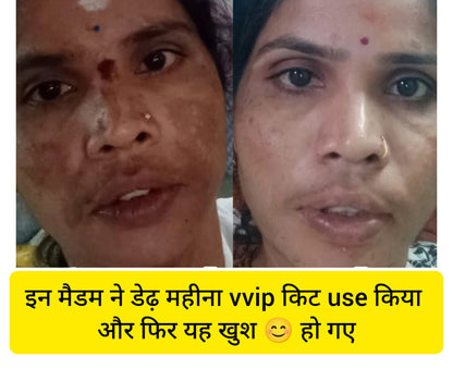 Beatking day cream, removes scar and pigment, for glowing skin