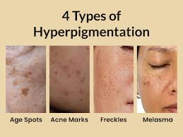 Beatking day and night cream 60+60g and Facewash 100ml combo