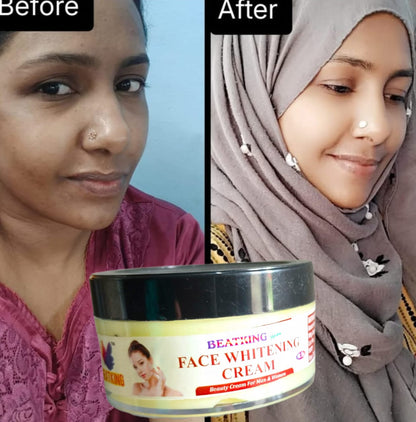 beatking face whitening cream with facewash , reduce dark spot and brightens skin tone 50g