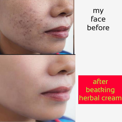 Beatking day and night cream 60+60g and Facewash 100ml combo