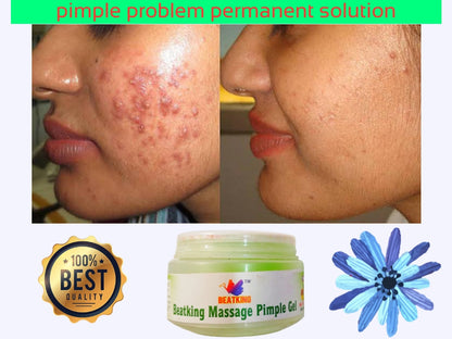 Beatking pimple massage gel, Tea Tree Spot Gel Pimple Removal Face Cream with Tea Tree & Salicylic Acid For Acne & Pimples and acne soap 100g – 50g pack of 1 pcs