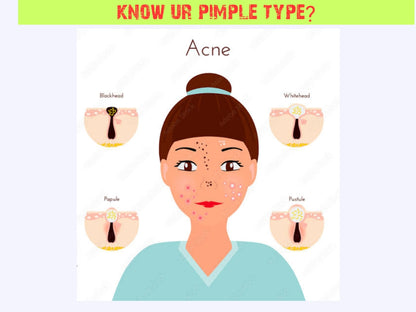 Beatking pimple massage gel, Tea Tree Spot Gel Pimple Removal Face Cream with Tea Tree & Salicylic Acid For Acne & Pimples and acne soap 100g – 50g pack of 1 pcs